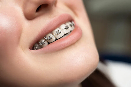 Best Orthodontist in Pimpri Chinchwad Best Orthodontist in Pimpri Chinchwad Pune
