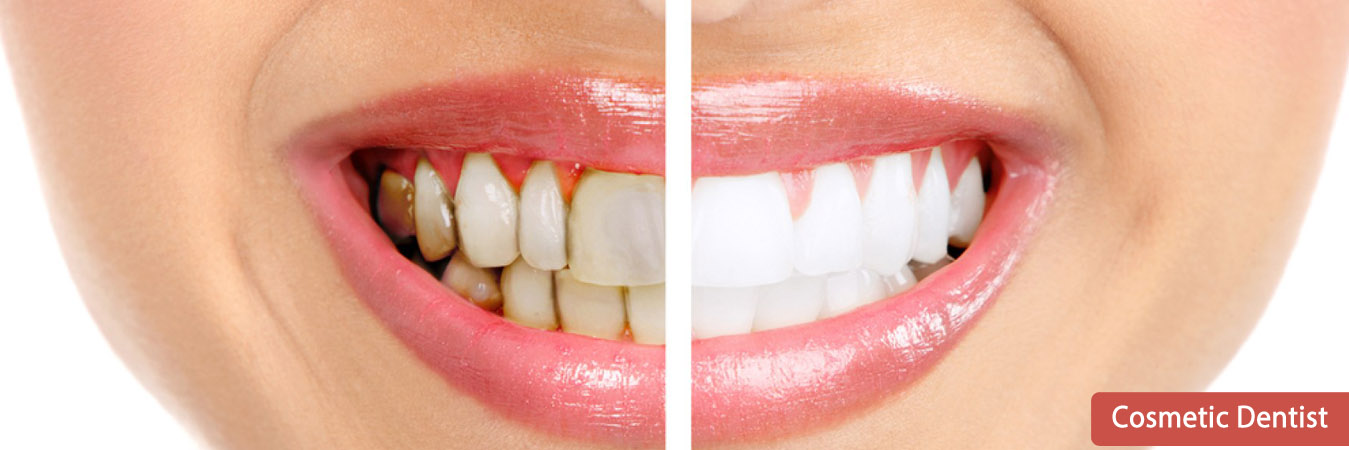 Best Cosmetic Dentist in Pimpri Chinchwad Pune Best Cosmetic Dentist in Pimpri Chinchwad Pune