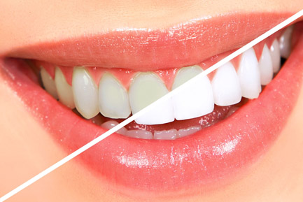 Best Cosmetic Dentist in Pimpri Chinchwad Pune