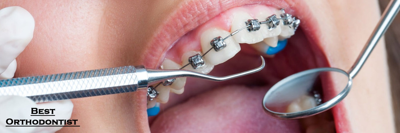 Best Orthodontist in Pimpri Chinchwad Best Orthodontist in Pimpri Chinchwad Pune