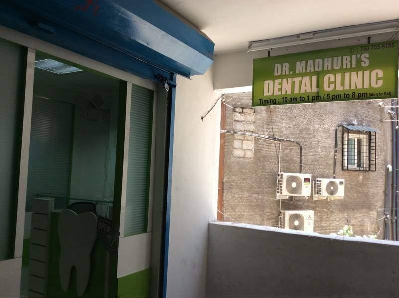 Root Canal Treatment in Pimpri Chinchwad Pune